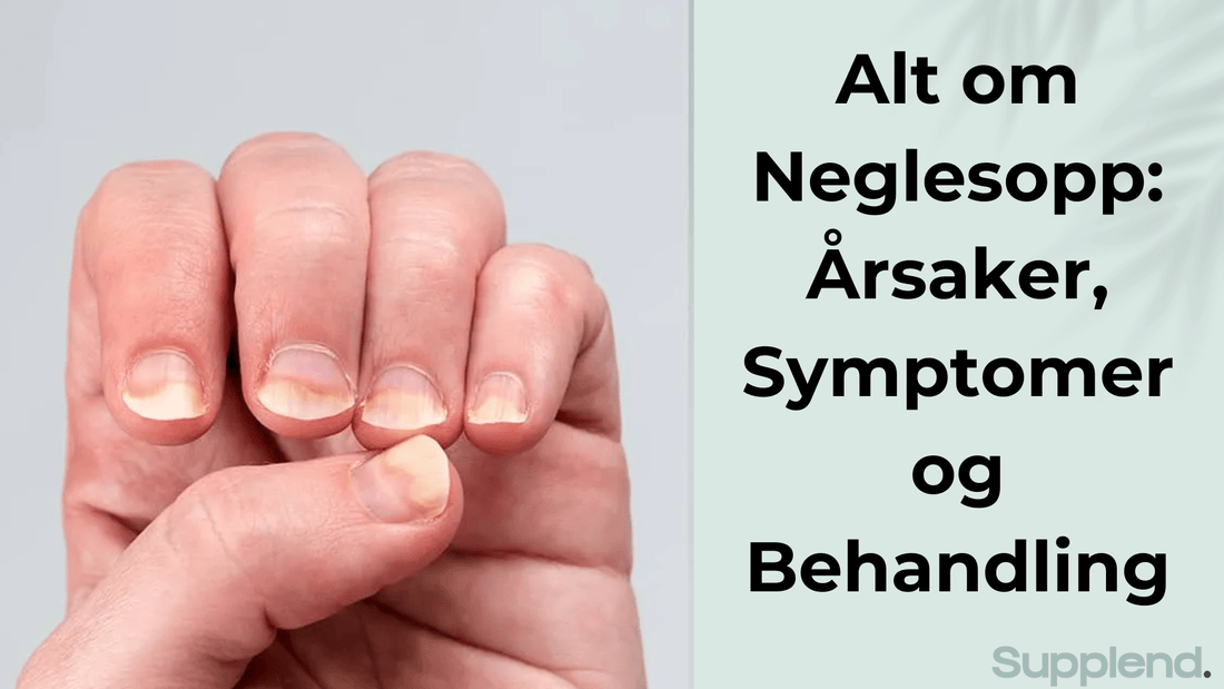 Neglesopp: Årsaker, Symptomer og Behandling