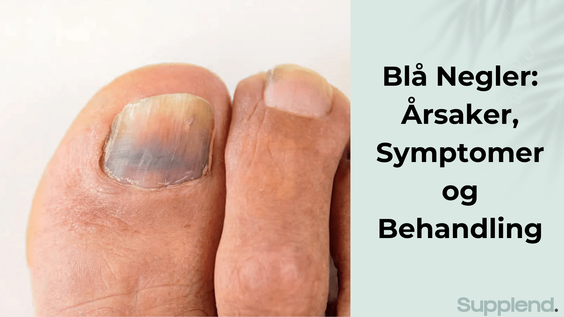 Blå Negler: Årsaker, Symptomer og Behandling | Supplend Norge